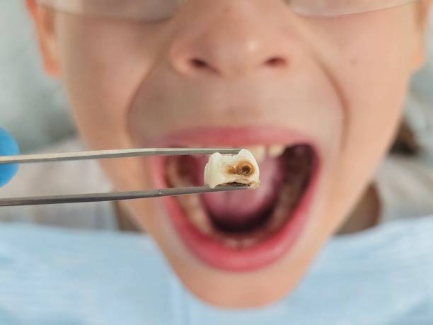 Best Urgent Dental Care  in Tuntutuli, AK